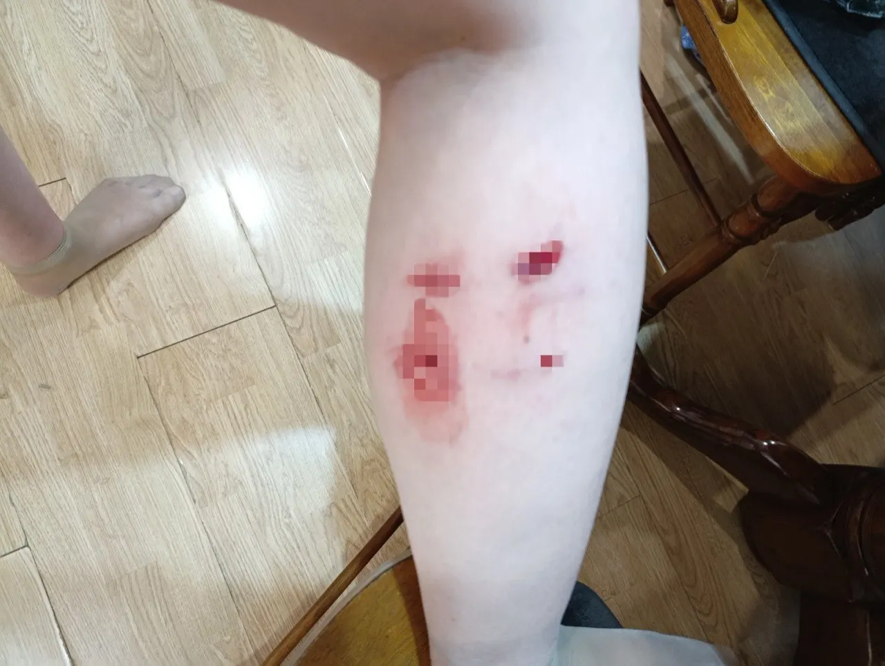 Жительница Уфы рассказала, что 11 июня трое крупных собак напали на неё во дворе на Адмирала Ушакова, одну укусили за ногу. Бригада отлова выезжала, но собак не обнаружила.